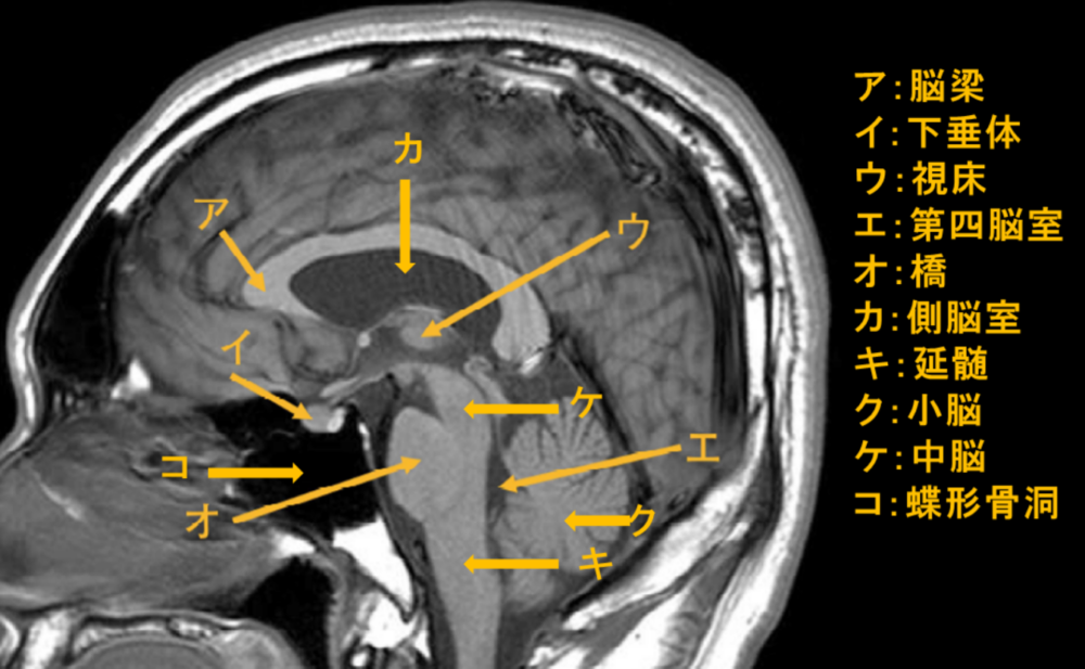 神経系　正常解剖